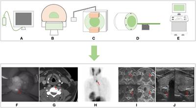 The magic mirror: a novel intraoperative monitoring method for parathyroid glands